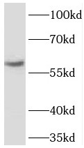 TBL1XR1 antibody|TBL1XR1抗体