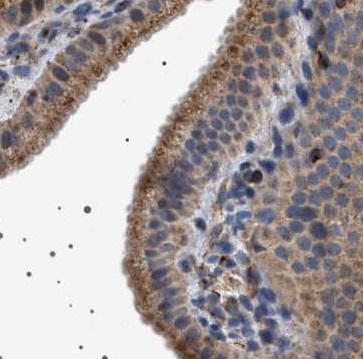 TRUB2 antibody|TRUB2抗体