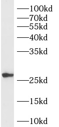 RAB33B antibody|RAB33B抗体