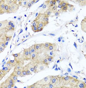 PSTPIP1 antibody|PSTPIP1抗体