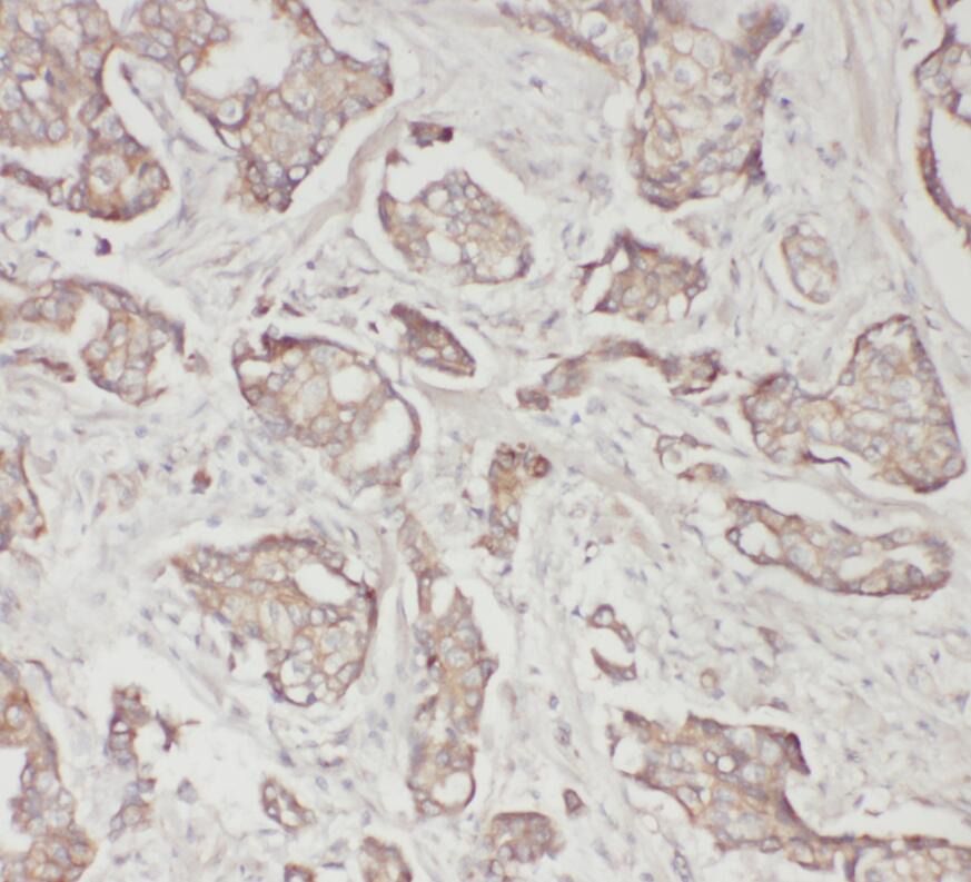 SPP1 antibody|SPP1抗体 FNab06033