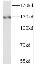 POLR3B antibody|POLR3B抗体