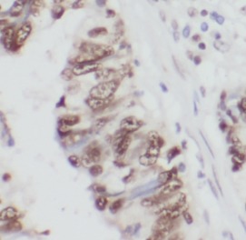 THAP1 antibody|THAP1抗体