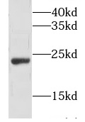 GH1 antibody|GH1抗体 FNab03659