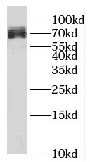 SPATA13 antibody|SPATA13抗体