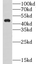 GPR22 antibody|GPR22抗体