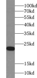 ACOT6 antibody|ACOT6抗体