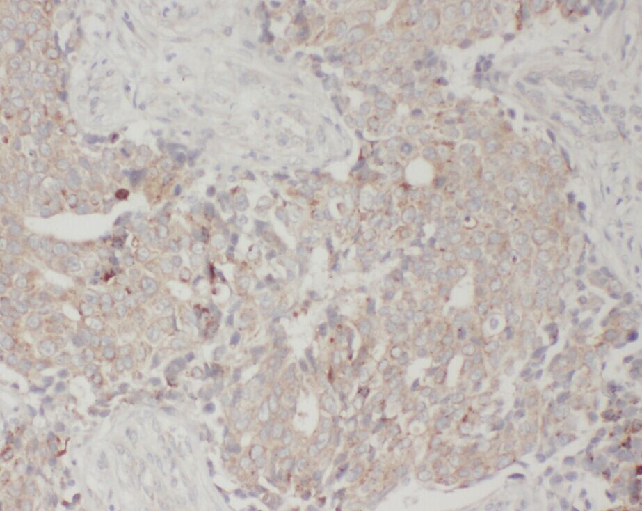 WDFY3 antibody|WDFY3抗体