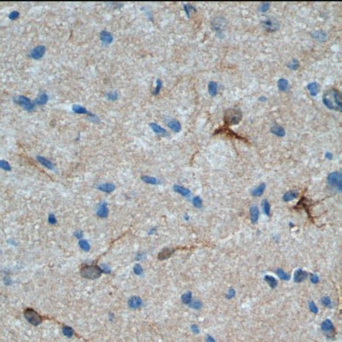 RHEB antibody|RHEB抗体 FNab07280