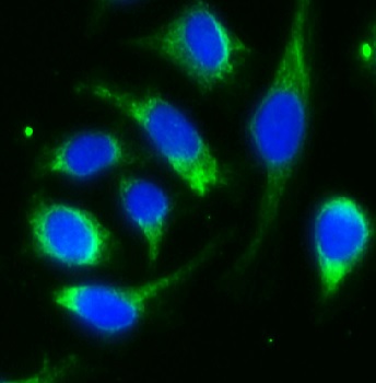 ALDH1L1 antibody|ALDH1L1抗体
