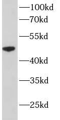 CYP2D6 antibody|CYP2D6抗体 FNab0