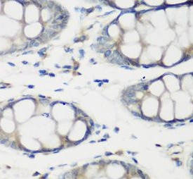 TNNC2 antibody|TNNC2抗体