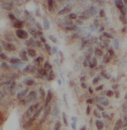 MED1 antibody|MED1抗体