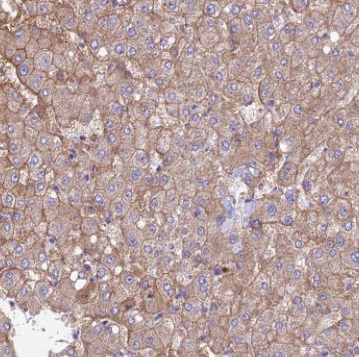 SUOX antibody|SUOX抗体