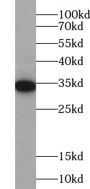 ZC3H8 antibody|ZC3H8抗体