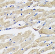 NPPA antibody|NPPA抗体