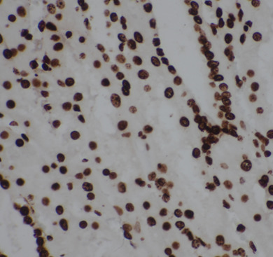 Histone H3.3 antibody|Histone 