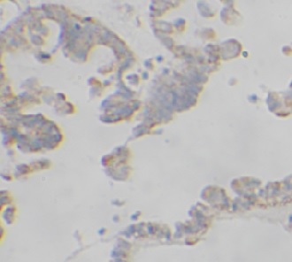 RAD51 antibody|RAD51抗体 FNab101