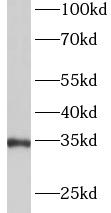 ANXA5 antibody|ANXA5抗体 FNab099