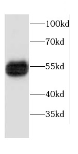 CPM antibody|CPM抗体
