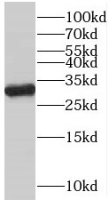 VDAC1 antibody|VDAC1抗体 FNab093