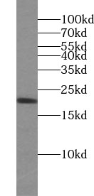 UBE2V1 antibody|UBE2V1抗体