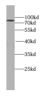 SCARB1 antibody|SCARB1抗体