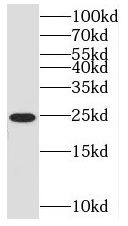 SAR1A antibody|SAR1A抗体 FNab076