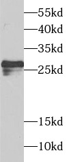 SPIN2B antibody|SPIN2B抗体