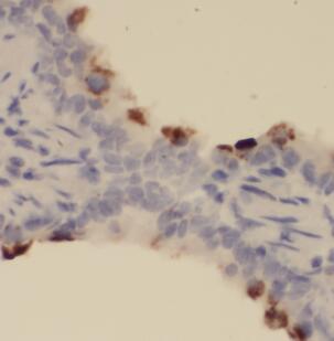 NLRP3 antibody|NLRP3抗体 FNab101