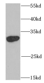 SNRPA antibody|SNRPA抗体