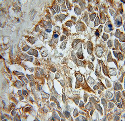 STMN2 antibody|STMN2抗体