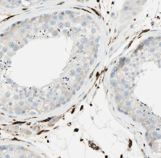 RNASEH2A antibody|RNASEH2A抗体