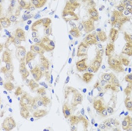 MIP antibody|MIP抗体