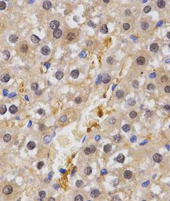 HSF2 antibody|HSF2抗体 FNab04037