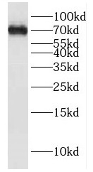 FAF1 antibody|FAF1抗体 FNab02945