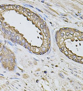 S100A12 antibody|S100A12抗体