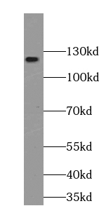 PALLD-Specific antibody|PALLD抗