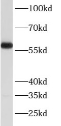 ATP6V1B2 antibody|ATP6V1B2抗体