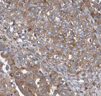 MUC16 antibody|MUC16抗体 FNab054