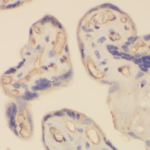 RHOBTB3 antibody|RHOBTB3抗体