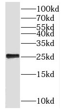 BLOC1S6 antibody|BLOC1S6抗体