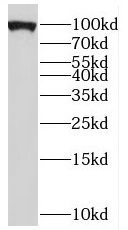 PYGB antibody|PYGB抗体 FNab06974
