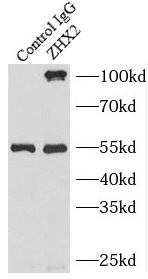 USP1 antibody|USP1抗体 FNab09302