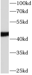 APOL1 antibody|APOL1抗体 FNab005