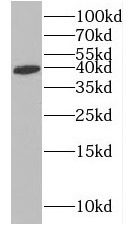 GYG1 antibody|GYG1抗体