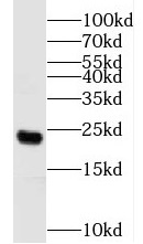N6AMT1 antibody|N6AMT1抗体