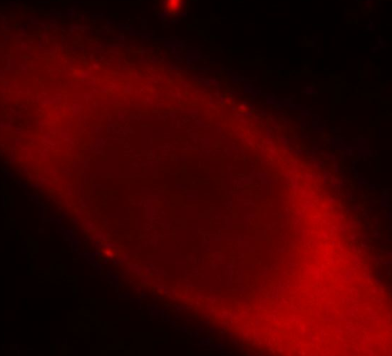 LGALS3 antibody|LGALS3抗体 FNab0