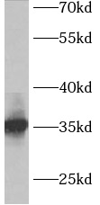 ACY3 antibody|ACY3抗体