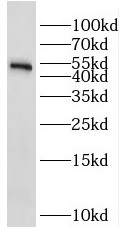 STK25 antibody|STK25抗体